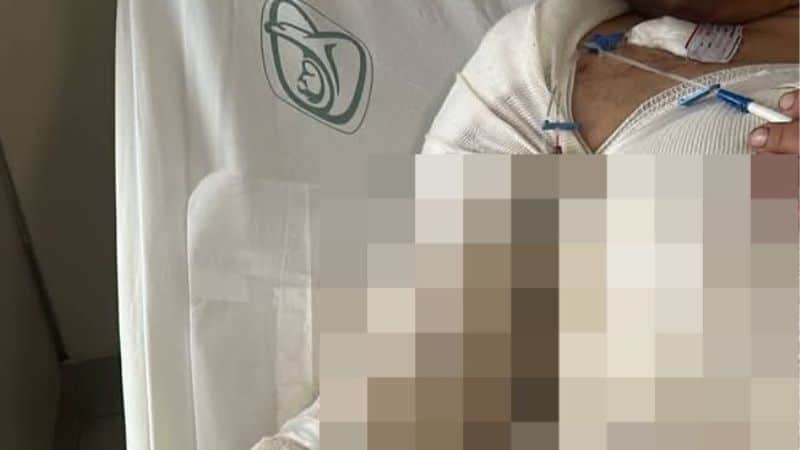 Mujer sobrevive a brutal ataque e incendio; su agresor sigue prófugo